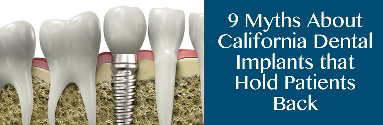 9 Myths About California Dental Implants that Hold Patients Back