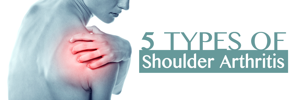 5 Types of Shoulder Arthritis in Louisiana